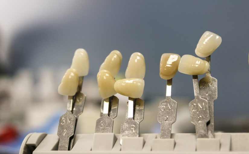 Śliczne nienaganne zęby również olśniewający prześliczny uśmiech to powód do płenego uśmiechu.